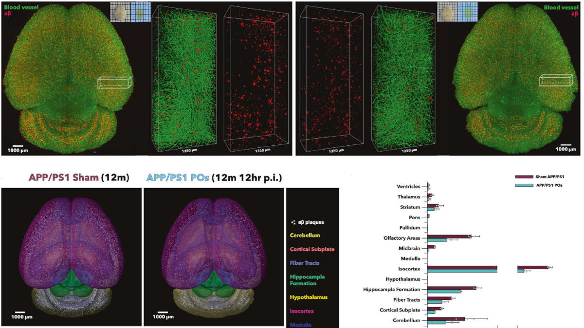 Quando la scienza è vittima della cattiva informazione: lo studio sulle nano-particelle che curano l’Alzaimher